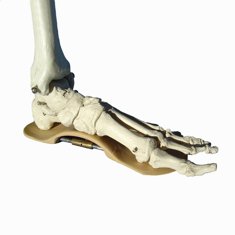skelet stopala
